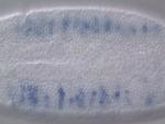IP01419-AU