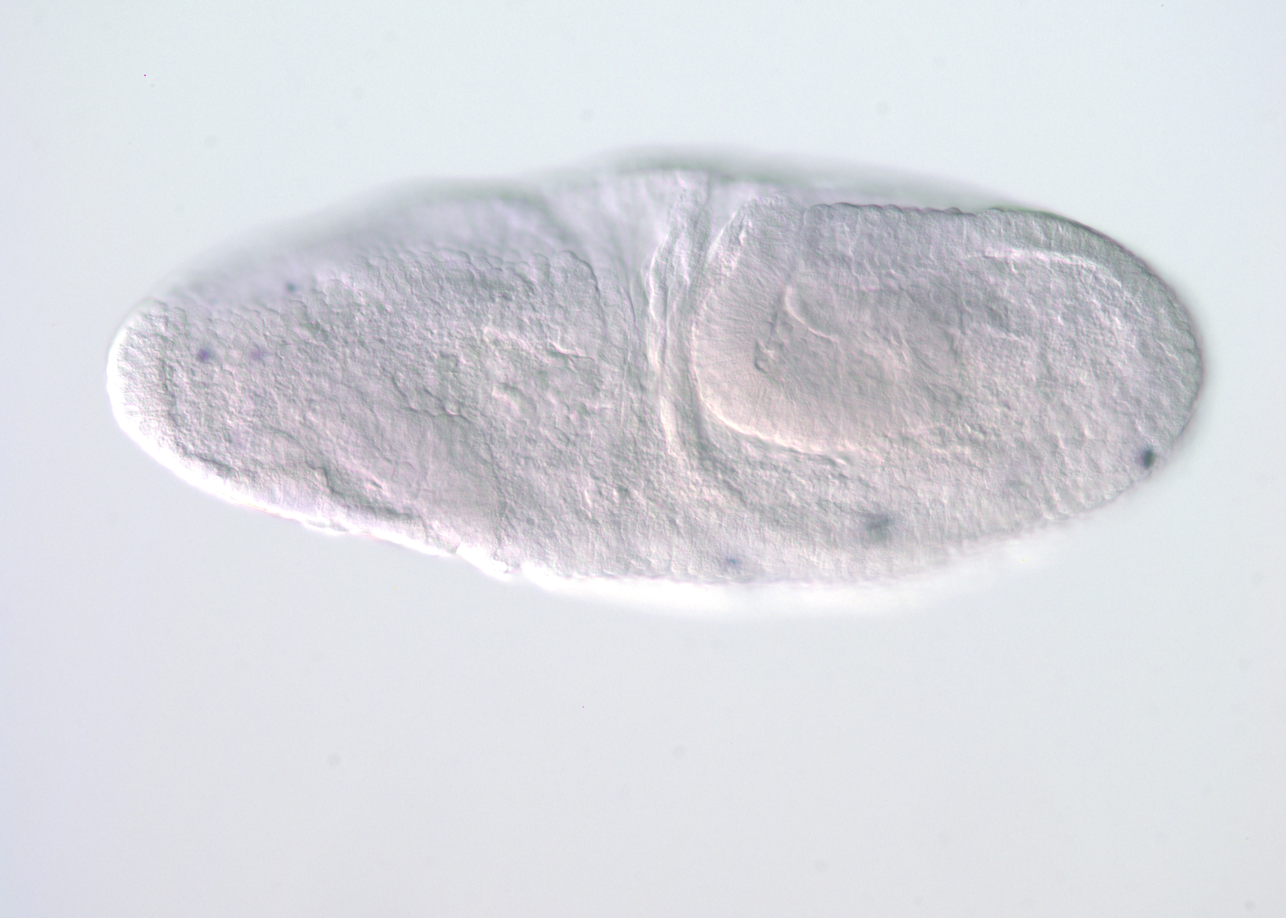 MIP14971