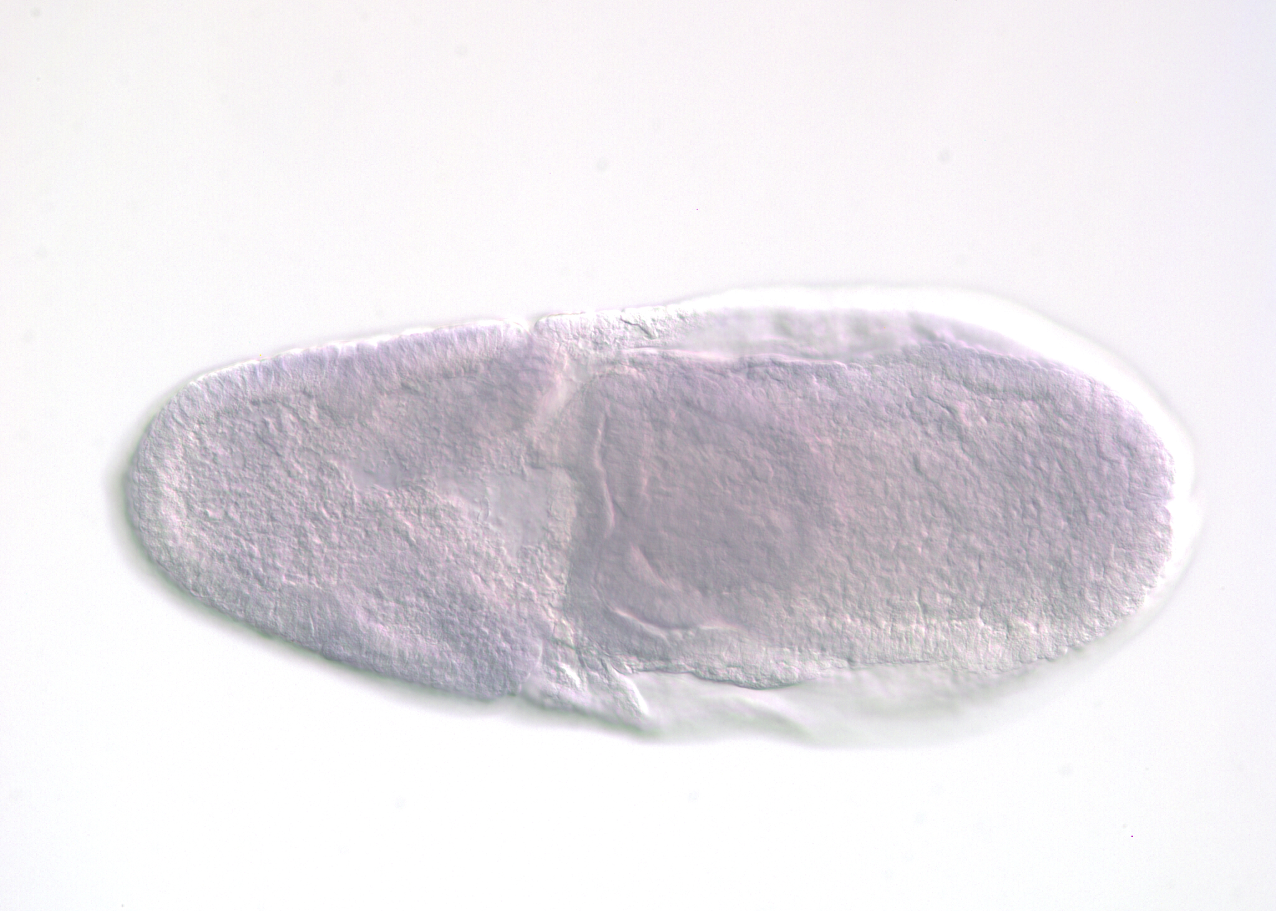 IP17193-smORF